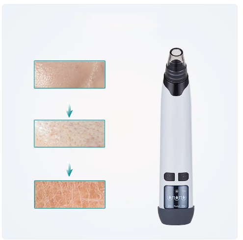 Blackhead remover vacuum pore cleansing suction tool with periodically better results GlowNest Co